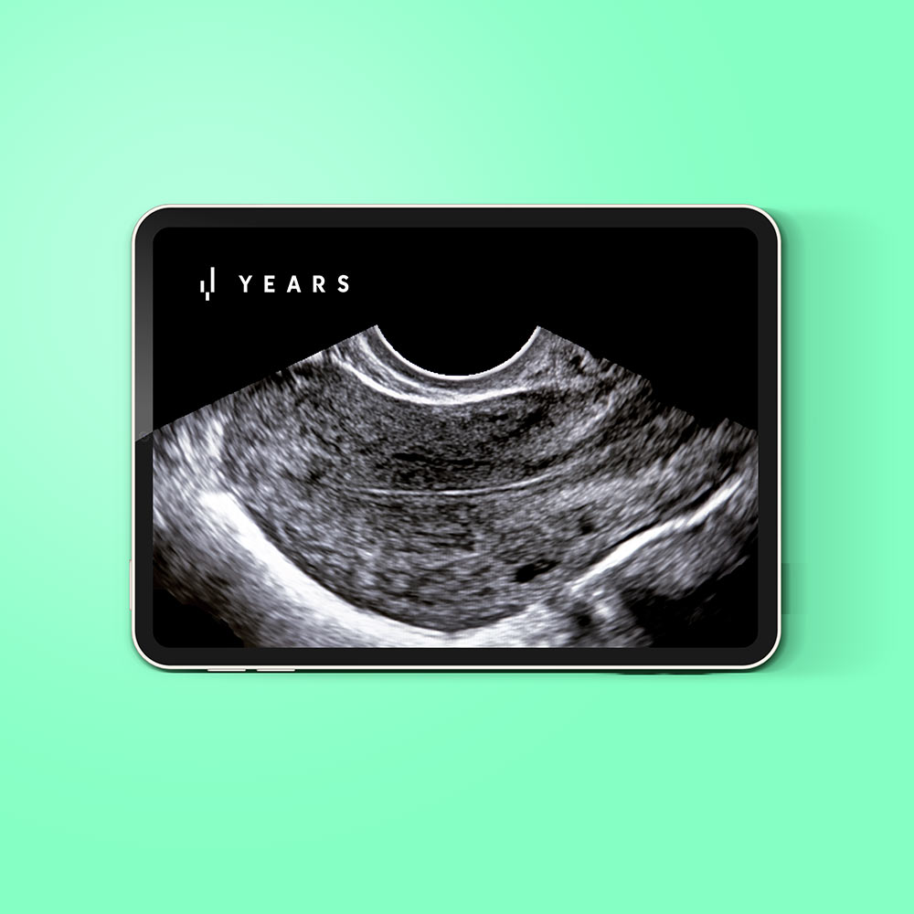 YEARS Core Ultrasound