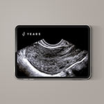 YEARS-Abdomen-Ultraschall